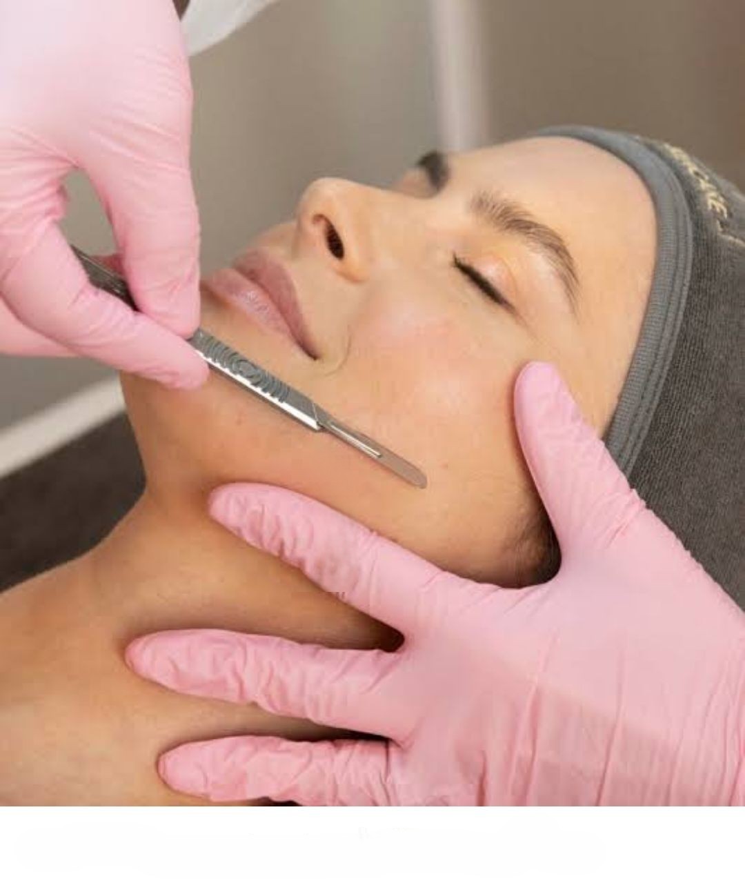 Dermaplane Facial